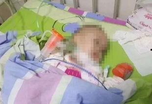 艾滋病毒最新爆料信息,突破性发现与防控策略